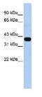 Mitochondrial E3 Ubiquitin Protein Ligase 1 antibody, ab84067, Abcam, Western Blot image 