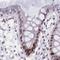 Nuclear Autoantigenic Sperm Protein antibody, NBP2-33929, Novus Biologicals, Immunohistochemistry frozen image 