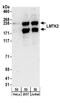 Serine/threonine-protein kinase LMTK2 antibody, A304-270A, Bethyl Labs, Western Blot image 