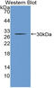 Cholinergic Receptor Nicotinic Beta 2 Subunit antibody, LS-C314791, Lifespan Biosciences, Western Blot image 