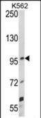 Unc-5 Netrin Receptor C antibody, PA5-72496, Invitrogen Antibodies, Western Blot image 