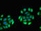 Vasohibin 2 antibody, LS-C679971, Lifespan Biosciences, Immunofluorescence image 