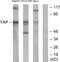 Yes Associated Protein 1 antibody, LS-C118901, Lifespan Biosciences, Western Blot image 