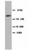 Prostaglandin-Endoperoxide Synthase 1 antibody, LS-C171548, Lifespan Biosciences, Western Blot image 
