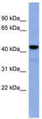 Early Growth Response 3 antibody, TA343460, Origene, Western Blot image 
