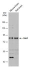 Disabled homolog 1 antibody, GTX119336, GeneTex, Western Blot image 