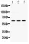 Crossover junction endonuclease EME1 antibody, PA5-79202, Invitrogen Antibodies, Western Blot image 
