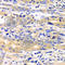 SARS antibody, A6733, ABclonal Technology, Immunohistochemistry paraffin image 