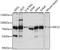 Kinesin-like protein KIF22 antibody, A05570-1, Boster Biological Technology, Western Blot image 