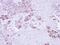 Epoxide Hydrolase 1 antibody, PA5-22020, Invitrogen Antibodies, Immunohistochemistry paraffin image 
