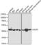 Sterol O-Acyltransferase 1 antibody, LS-C748331, Lifespan Biosciences, Western Blot image 