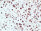 Acid Phosphatase 5, Tartrate Resistant antibody, LS-C744576, Lifespan Biosciences, Immunohistochemistry paraffin image 