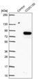 Coiled-Coil Domain Containing 155 antibody, PA5-54116, Invitrogen Antibodies, Western Blot image 