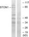 Stonin-1 antibody, LS-C119357, Lifespan Biosciences, Western Blot image 