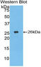 Leucine aminopeptidase  antibody, LS-C707570, Lifespan Biosciences, Western Blot image 
