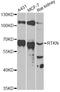RTKN antibody, LS-C748402, Lifespan Biosciences, Western Blot image 