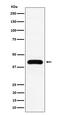 Mevalonate Diphosphate Decarboxylase antibody, M01631, Boster Biological Technology, Western Blot image 