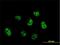 Centromere protein Q antibody, H00055166-M01, Novus Biologicals, Immunofluorescence image 