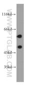 Rho GDP-dissociation inhibitor 1 antibody, 55214-1-AP, Proteintech Group, Western Blot image 