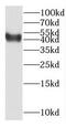 Neutrophil Cytosolic Factor 4 antibody, FNab05582, FineTest, Western Blot image 