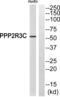 Serine/threonine-protein phosphatase 2A regulatory subunit B subunit gamma antibody, abx014869, Abbexa, Western Blot image 