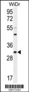 RILP-like protein 2 antibody, MBS9209387, MyBioSource, Western Blot image 