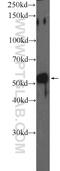 Glucokinase antibody, 15629-1-AP, Proteintech Group, Western Blot image 