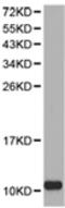 S100A8 antibody, TA322931, Origene, Western Blot image 