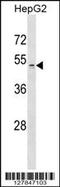 Zinc Finger DHHC-Type Containing 1 antibody, 55-128, ProSci, Western Blot image 