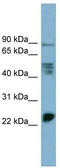 Myelin Protein Zero Like 1 antibody, TA339389, Origene, Western Blot image 