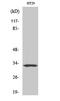 Olfactory Receptor Family 2 Subfamily T Member 1 antibody, A16371, Boster Biological Technology, Western Blot image 