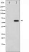 M-phase inducer phosphatase 2 antibody, TA325330, Origene, Western Blot image 