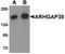 Rho GTPase Activating Protein 39 antibody, LS-C144407, Lifespan Biosciences, Western Blot image 