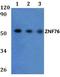 Zinc Finger Protein 76 antibody, A08898-1, Boster Biological Technology, Western Blot image 