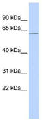 Methyl-CpG Binding Domain 4, DNA Glycosylase antibody, TA338199, Origene, Western Blot image 