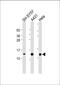 ADF antibody, M01219-2, Boster Biological Technology, Western Blot image 