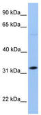 Dynein Axonemal Light Intermediate Chain 1 antibody, TA335774, Origene, Western Blot image 