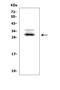 BMP And Activin Membrane Bound Inhibitor antibody, A07983-1, Boster Biological Technology, Western Blot image 