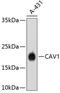 Caveolin 1 antibody, 13-796, ProSci, Western Blot image 