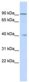 Zinc Finger Protein 263 antibody, TA343560, Origene, Western Blot image 