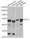 Dihydrolipoyllysine-residue succinyltransferase component of 2-oxoglutarate dehydrogenase complex, mitochondrial antibody, A13297, ABclonal Technology, Western Blot image 