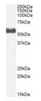 Cytochrome P450 Family 2 Subfamily D Member 6 antibody, orb1797, Biorbyt, Western Blot image 