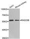 RAD23 Homolog B, Nucleotide Excision Repair Protein antibody, STJ28924, St John