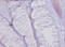 Collagen Type XVII Alpha 1 Chain antibody, A52130-100, Epigentek, Immunohistochemistry paraffin image 