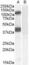 Erythrocyte Membrane Protein Band 4.1 Like 2 antibody, NBP1-06034, Novus Biologicals, Western Blot image 