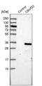 Chromosome 8 Open Reading Frame 33 antibody, PA5-55191, Invitrogen Antibodies, Western Blot image 