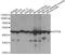 ATP Synthase F1 Subunit Beta antibody, A5769, ABclonal Technology, Western Blot image 