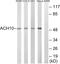 Cholinergic Receptor Nicotinic Alpha 10 Subunit antibody, GTX87783, GeneTex, Western Blot image 