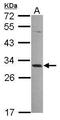 Melanoma-associated antigen 4 antibody, GTX116357, GeneTex, Western Blot image 