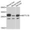 Methyltransferase Like 7B antibody, LS-C346279, Lifespan Biosciences, Western Blot image 